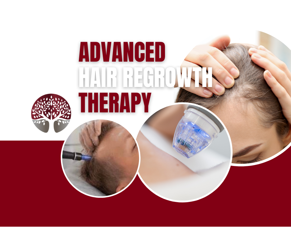 Hair REgrowth Non-surgical shockwave scalp treatment for improving hair density